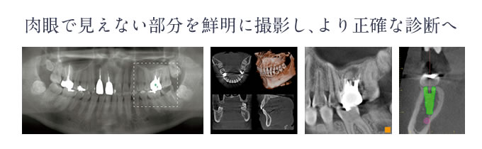 肉眼で見えない部分を鮮明に撮影し、より正確な診断へ